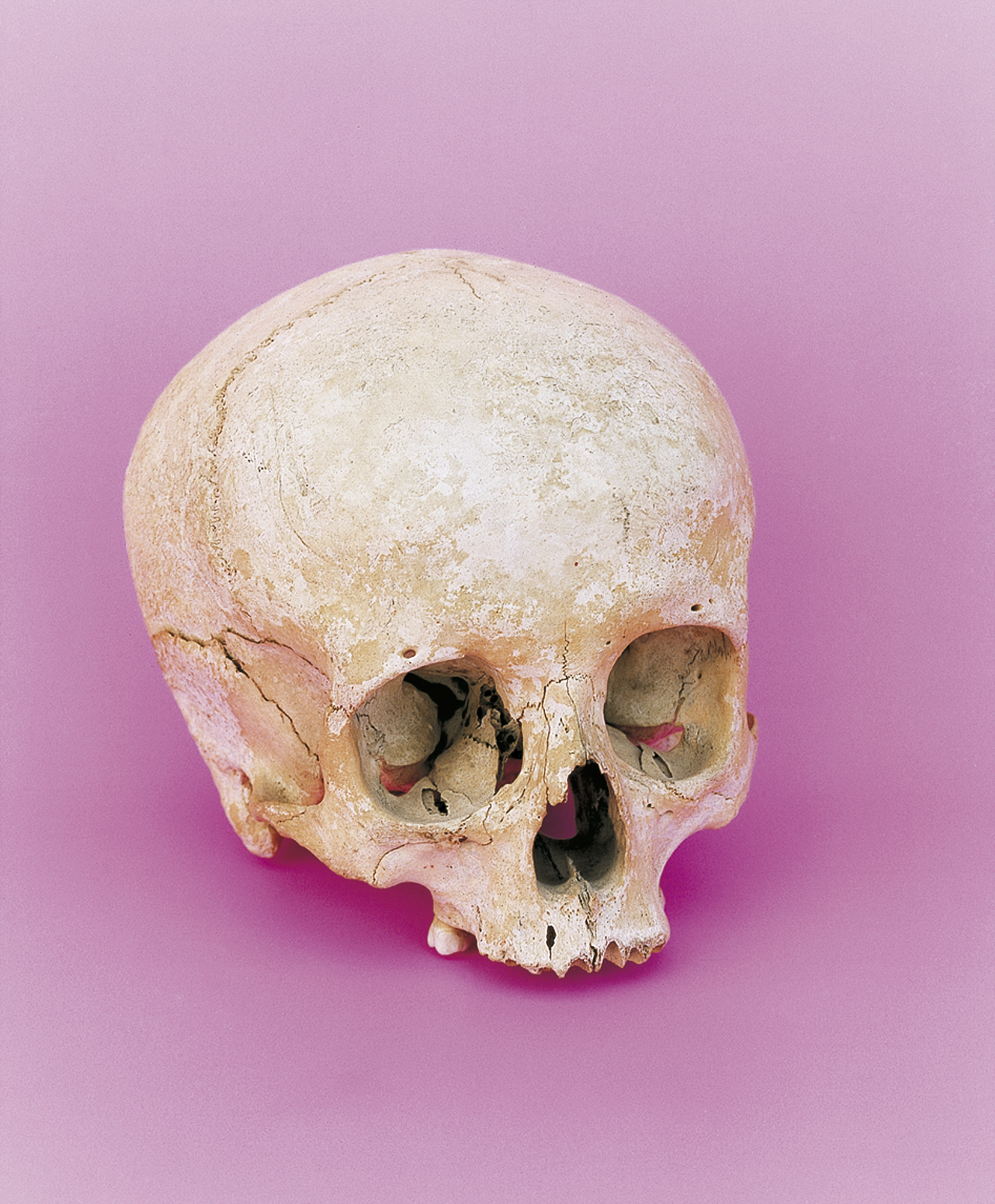 Shahbazi | Collection Pictet